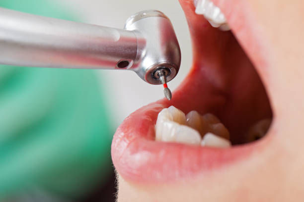 Best Urgent Tooth Repair  in East Merrimack, NH